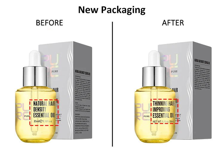 PURC PURC Ginger Hair Growth Oil – Fast Hair Loss Treatment & Hair Repair Solution Hair Growth Oil Fast Hair Loss Treatment Smoothing Repair Damaged Hair Growth Products for Men Women Hair Care