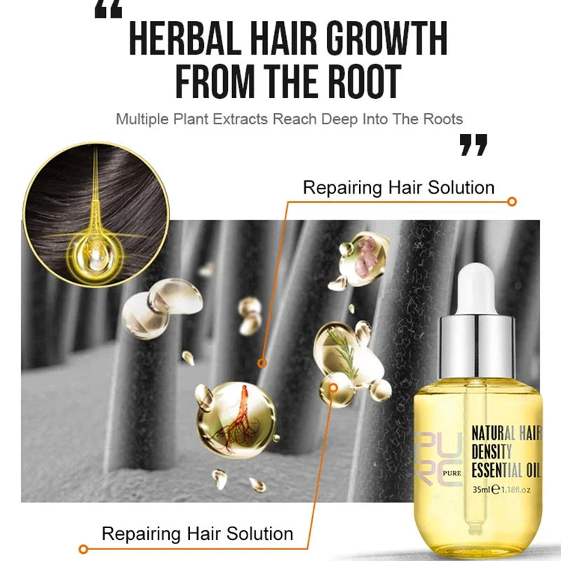 PURC PURC Ginger Hair Growth Oil – Fast Hair Loss Treatment & Hair Repair Solution Hair Growth Oil Fast Hair Loss Treatment Smoothing Repair Damaged Hair Growth Products for Men Women Hair Care