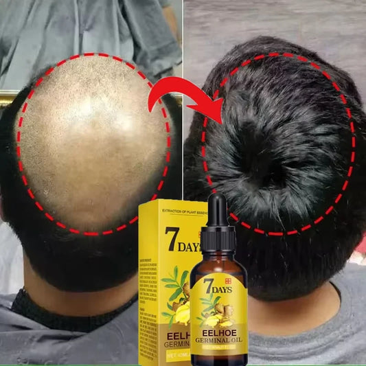 Fast Ginger Hair Growth Serum – 7-Day Hair Regrowth &amp; Scalp Care Treatment