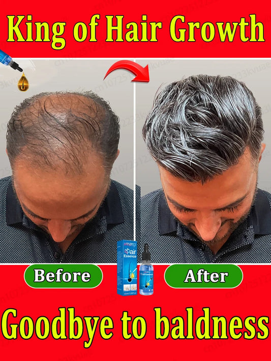 Most Effective Hair Growth Essential Oil – Expert Certified for Baldness Repair &amp; Hair Regrowth